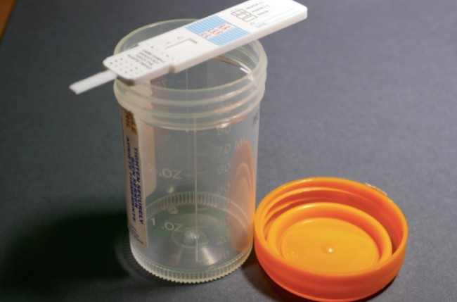 A urine THC drug test
